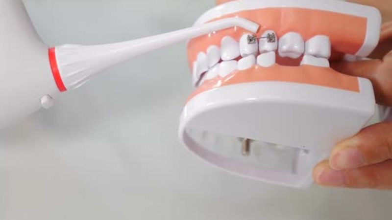Details On Teeth Whitening