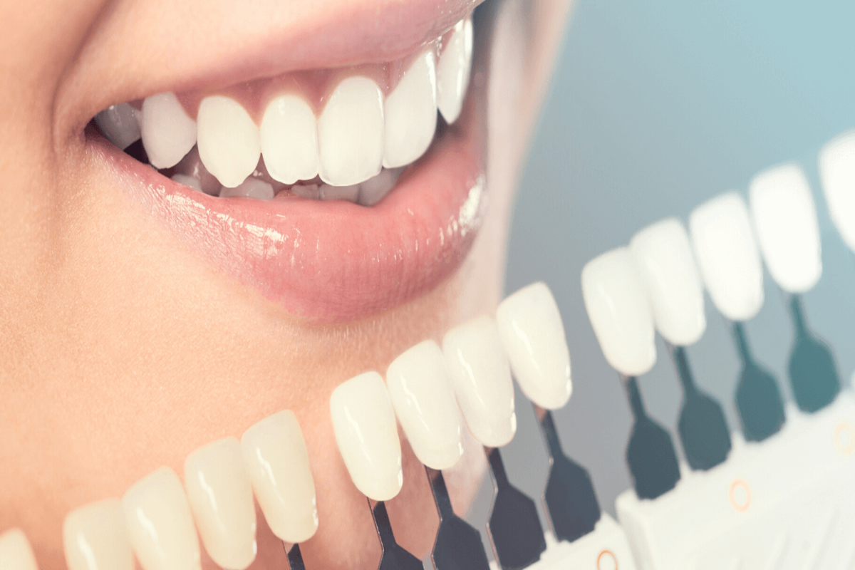 A Synopsis Of Dental Implants Treatment