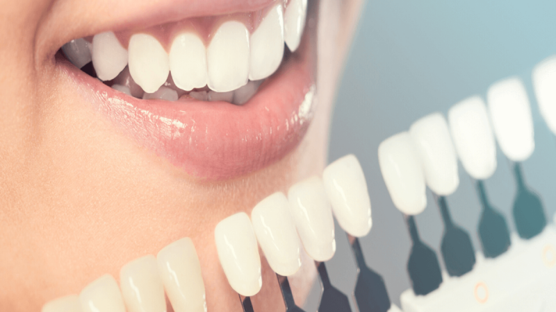A Synopsis Of Dental Implants Treatment