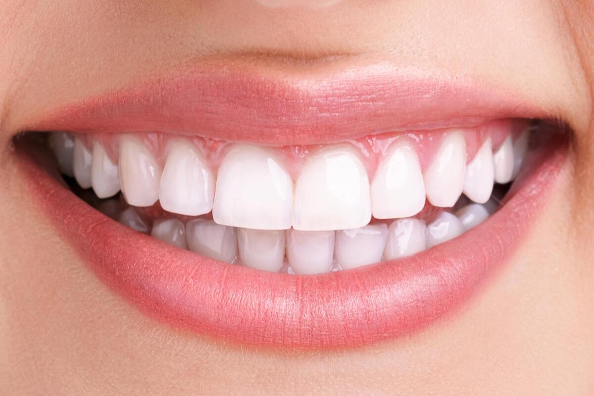 All You Want To Know About The Smile Reconstruction